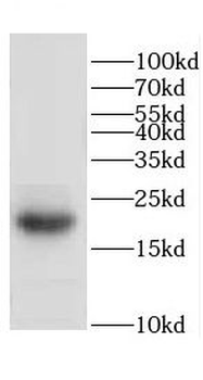 CETN2 Antibody
