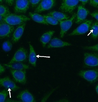 CEP290 Antibody