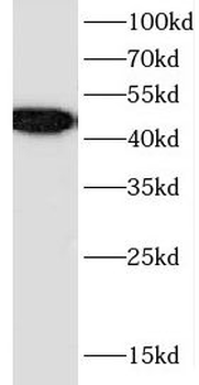 CEP44 Antibody