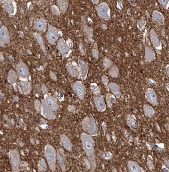CEP44 Rabbit Polyclonal Antibody