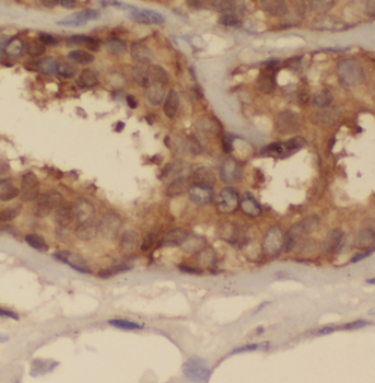 CEP97 Rabbit Polyclonal Antibody