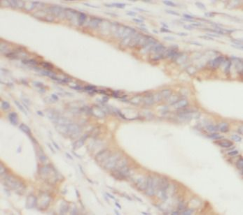 CES3 Rabbit Polyclonal Antibody