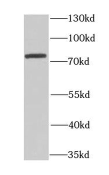 CETP Antibody