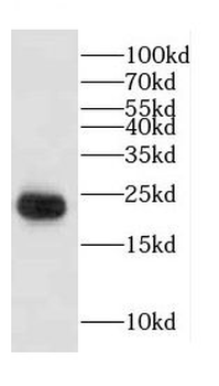 CGGBP1 Antibody