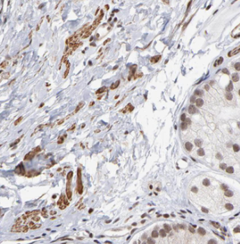 CGGBP1 Rabbit Polyclonal Antibody