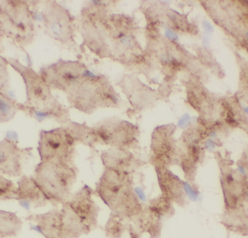 CHCHD10 Rabbit Polyclonal Antibody