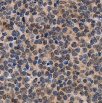 CHD2 Rabbit Polyclonal Antibody