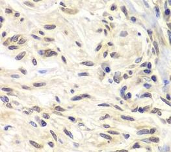 CHEK1 Rabbit Polyclonal Antibody