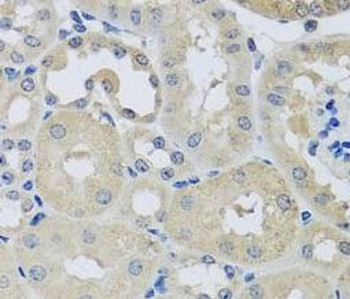 CHMP1B Rabbit Polyclonal Antibody