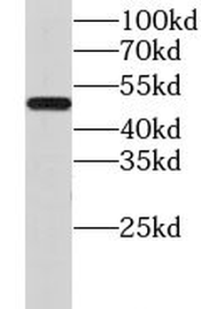 CHMP7 Rabbit Polyclonal Antibody