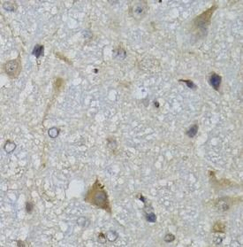 CHN1 Rabbit Polyclonal Antibody
