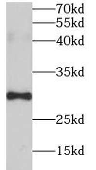 DDIT3 Rabbit Polyclonal Antibody
