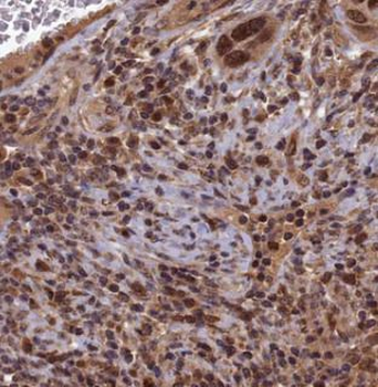 DDIT3 Rabbit Polyclonal Antibody