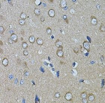 CHRFAM7A Rabbit Polyclonal Antibody