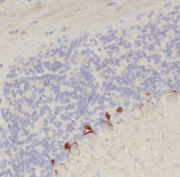 CHRNB3 Antibody