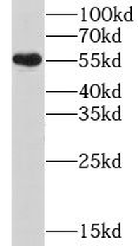 CHRNB4 Antibody