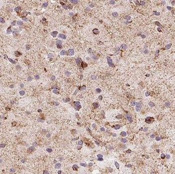 CHST10 Rabbit Polyclonal Antibody
