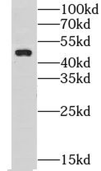 CHST14 Antibody