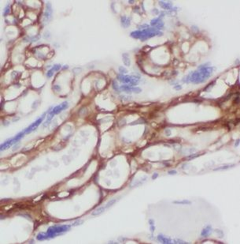 CHST14 Rabbit Polyclonal Antibody