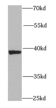 CIAO1 Rabbit Polyclonal Antibody