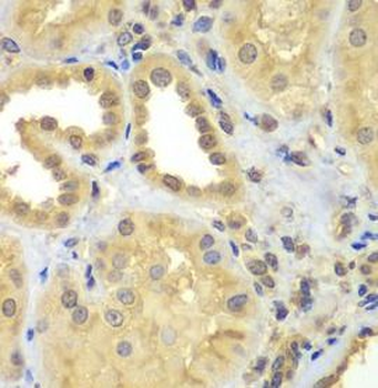 CIAO1 Rabbit Polyclonal Antibody