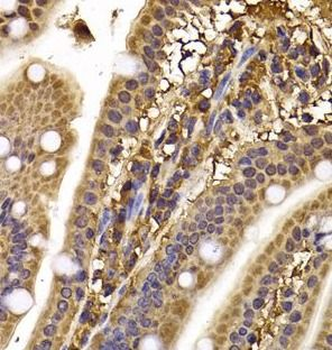 CLASP1 Rabbit Polyclonal Antibody