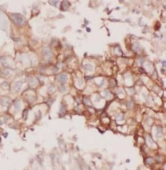 CLDN1 Rabbit Polyclonal Antibody