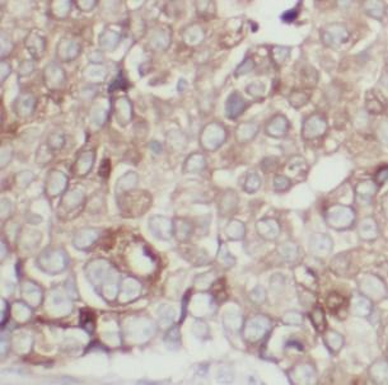 CLDN3 Rabbit Polyclonal Antibody