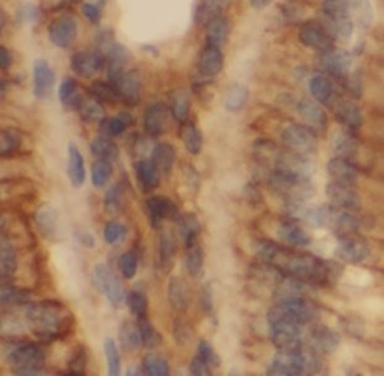 CLCA2 Rabbit Polyclonal Antibody