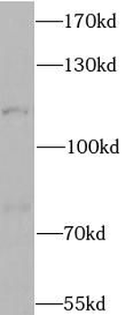 CLCN1 Antibody