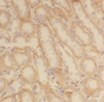 CLCNKA Rabbit Polyclonal Antibody