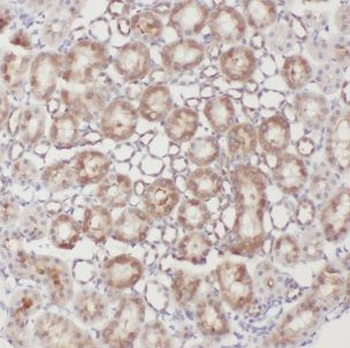 CLEC18A Rabbit Polyclonal Antibody