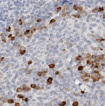 CLEC4D Antibody