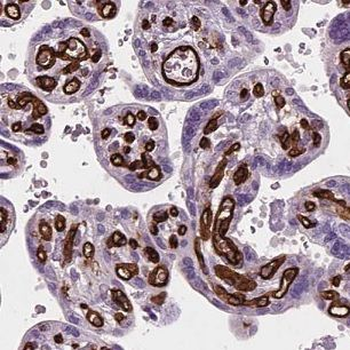 CLIC3 Rabbit Polyclonal Antibody