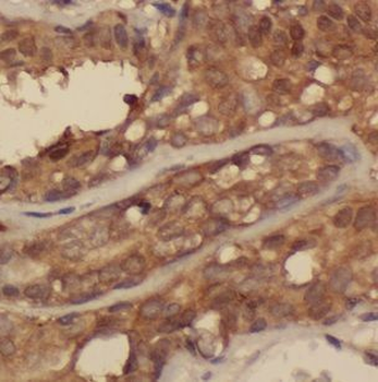 CLINT1 Rabbit Polyclonal Antibody
