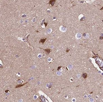CLN3 Rabbit Polyclonal Antibody