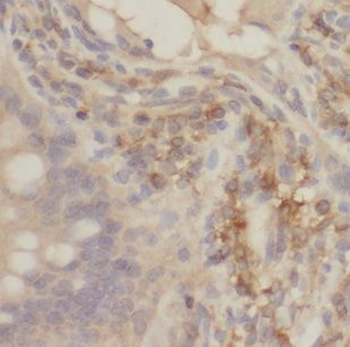 CLN6 Rabbit Polyclonal Antibody