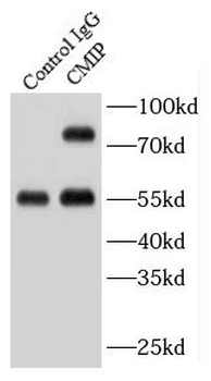 CMIP Rabbit Polyclonal Antibody