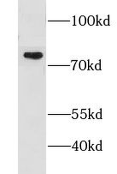 CMIP Rabbit Polyclonal Antibody