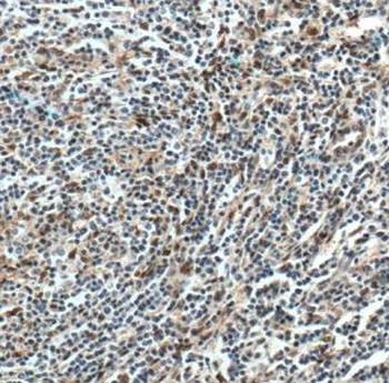 CMIP Rabbit Polyclonal Antibody