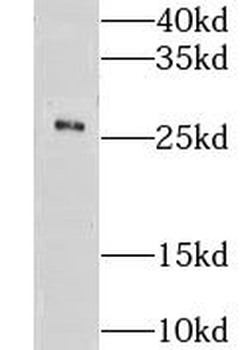 CMTM8 Antibody