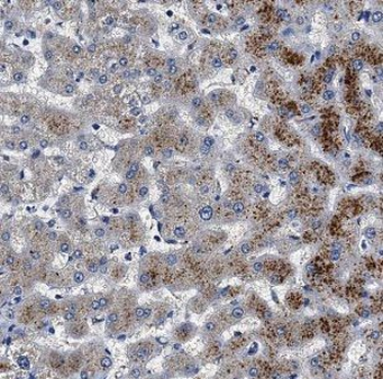 CMTM8 Rabbit Polyclonal Antibody