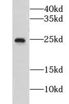 CNBP Antibody
