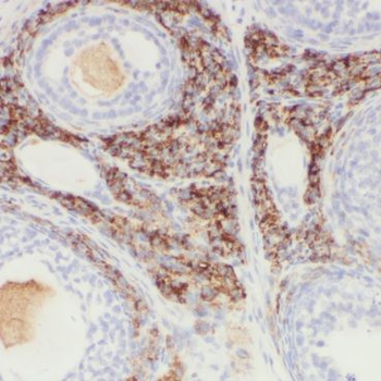CNBP Rabbit Polyclonal Antibody
