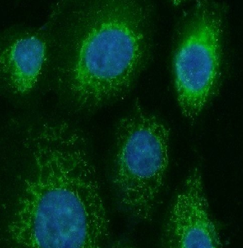 CNDP1 Antibody