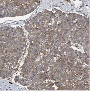 CNKSR1 Rabbit Polyclonal Antibody