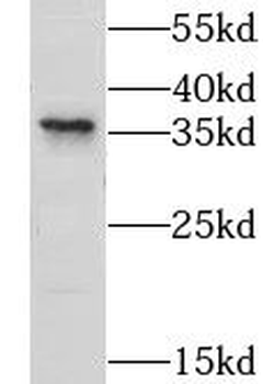 CNN3 Rabbit Polyclonal Antibody