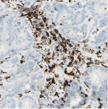 CNN3 Rabbit Polyclonal Antibody