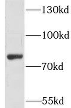 CNNM3 Rabbit Polyclonal Antibody