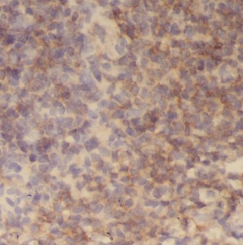 CNNM3 Rabbit Polyclonal Antibody